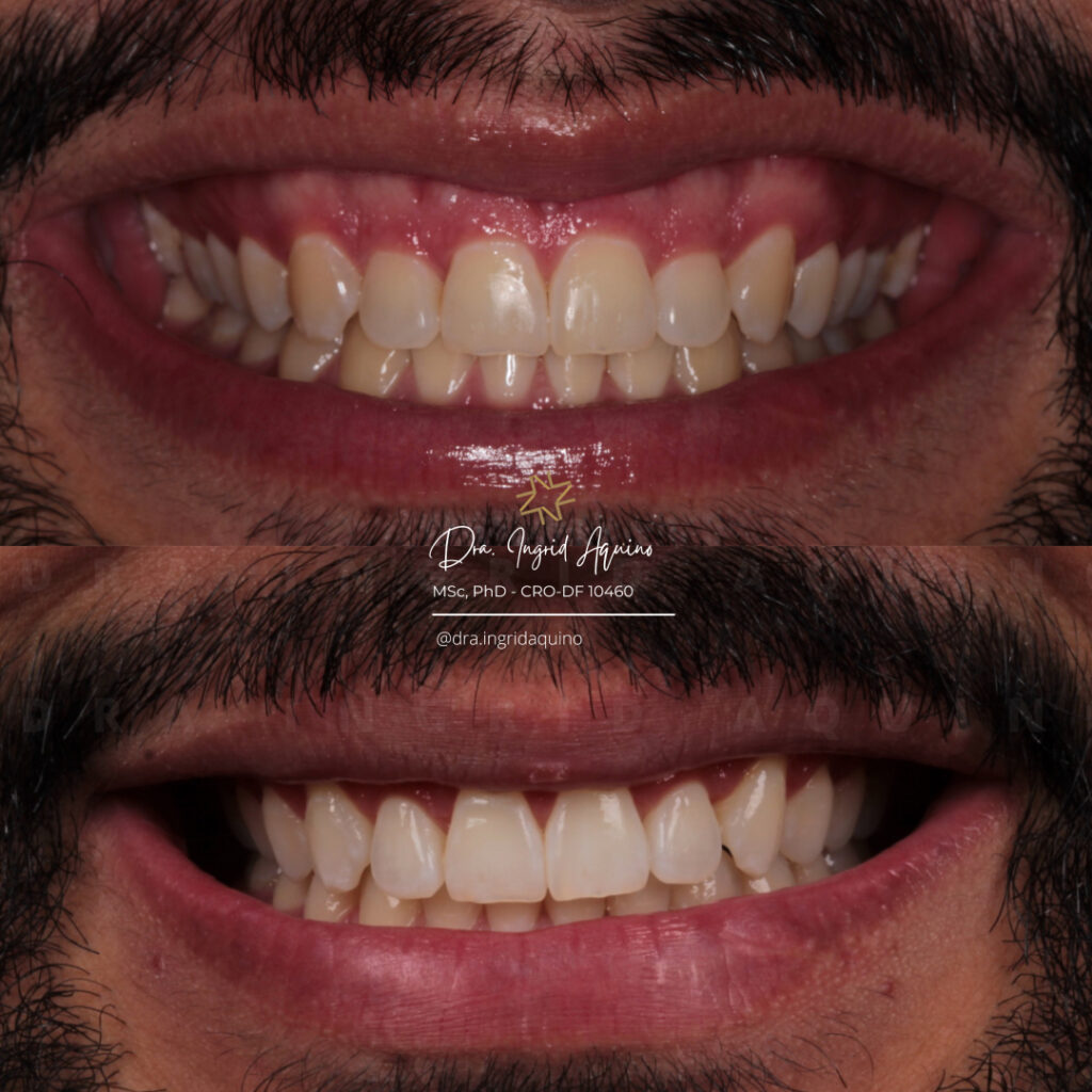 DEP-SORRISO-001