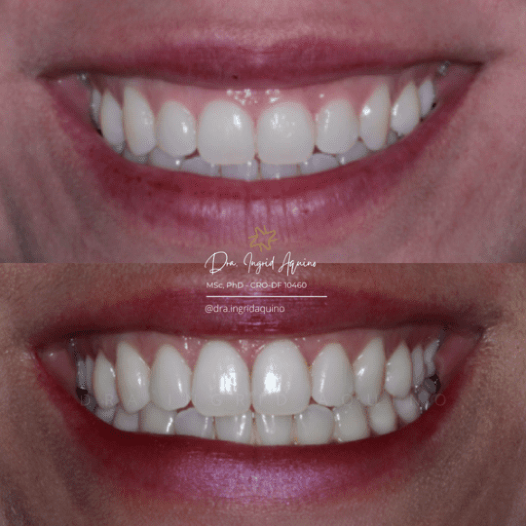 DEP-SORRISO-002
