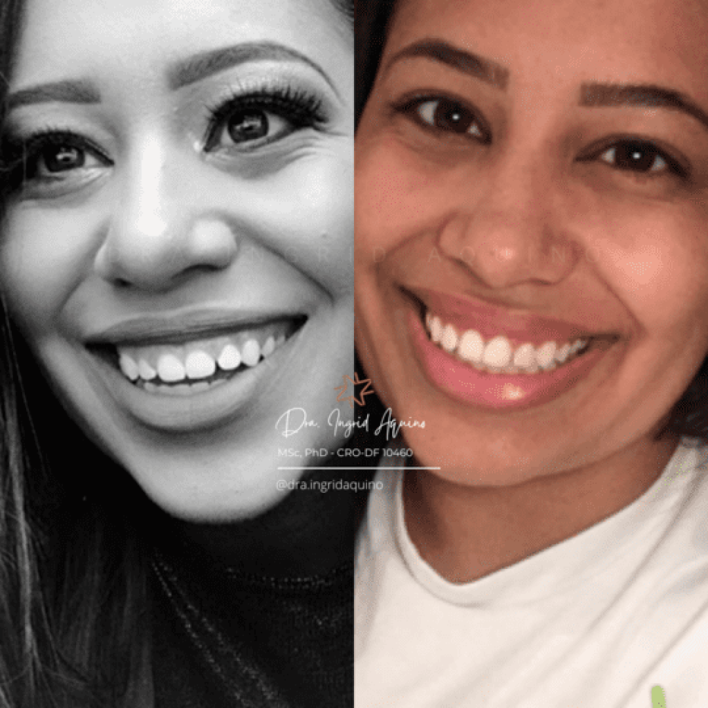 DEP-SORRISO-004