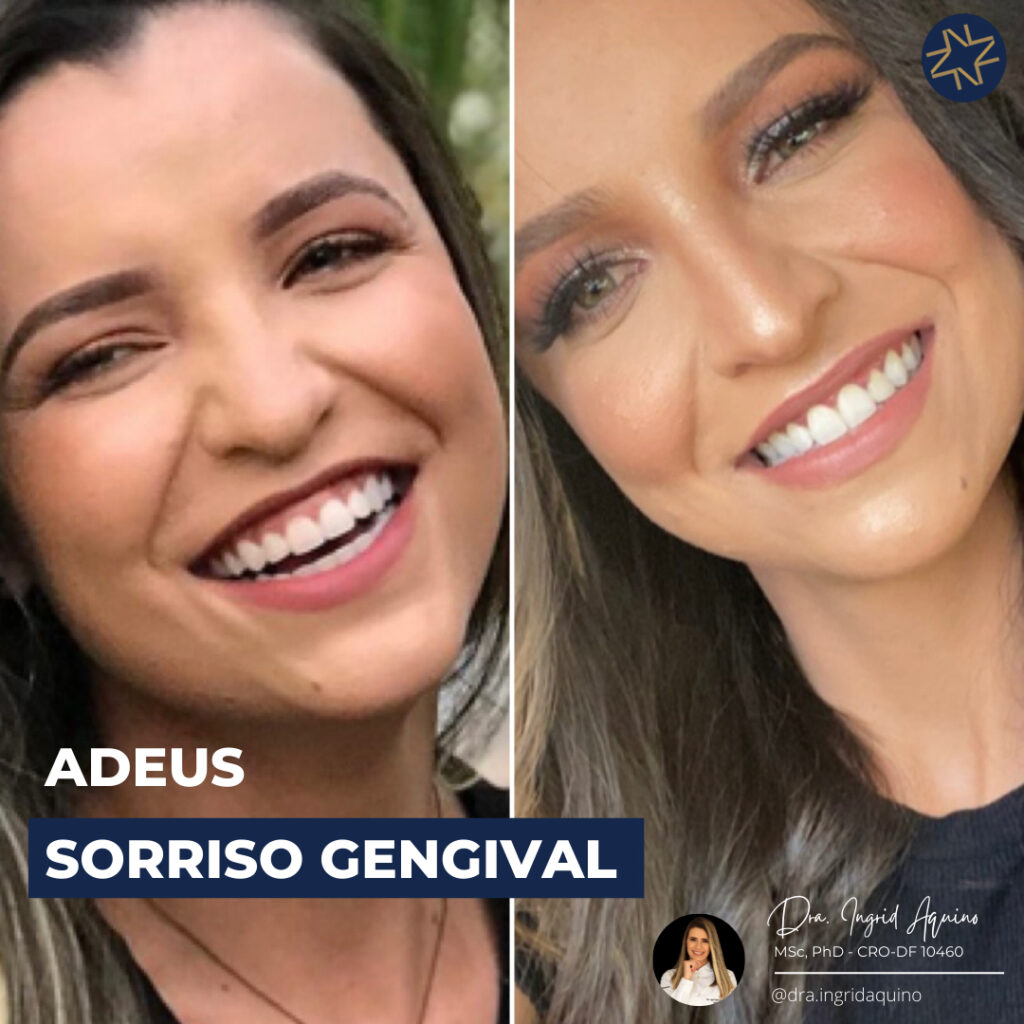 DEP-SORRISO-005