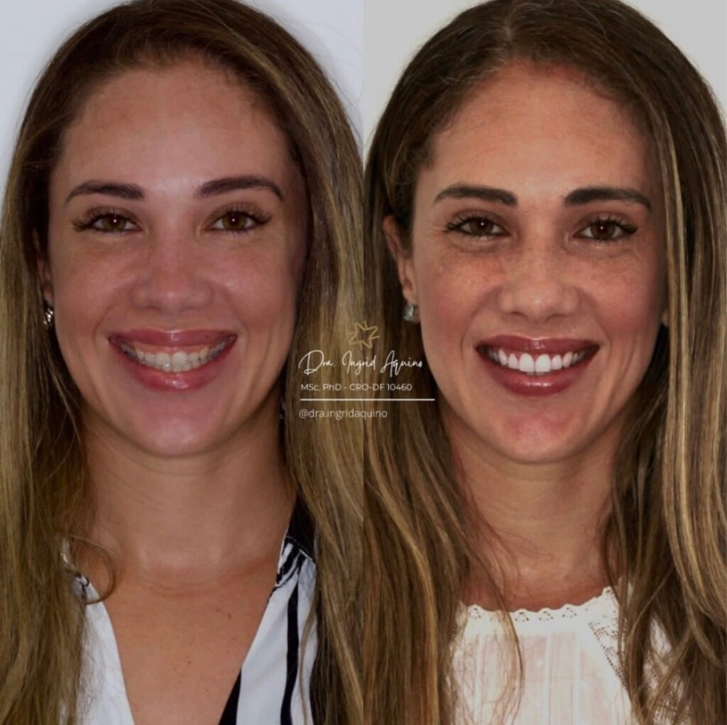 DEP-SORRISO-006