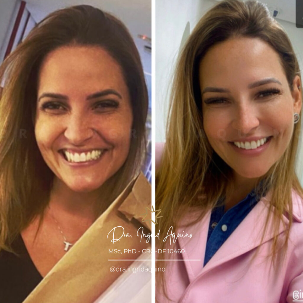 DEP-SORRISO-007