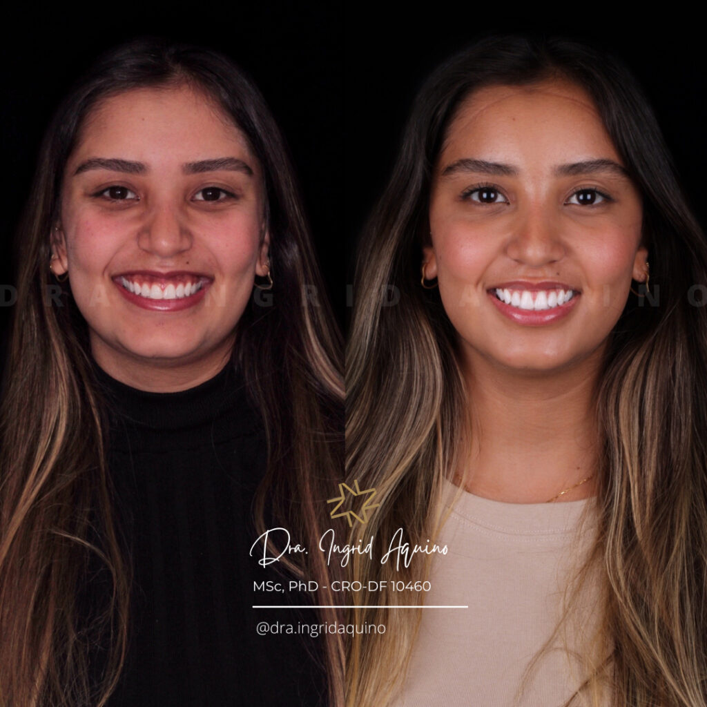 DEP-SORRISO-008