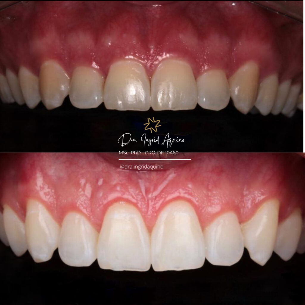 DEP-SORRISO-009