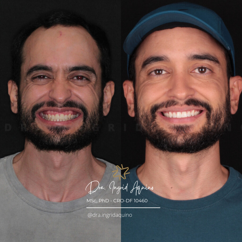 DEP-SORRISO-010