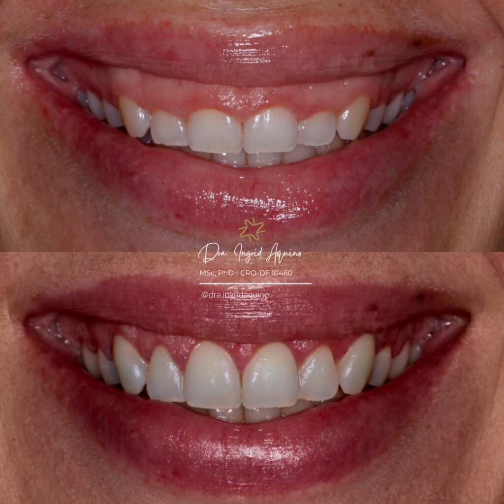 DEP-SORRISO-011
