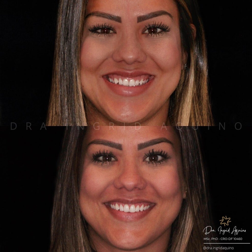 DEP-SORRISO-012